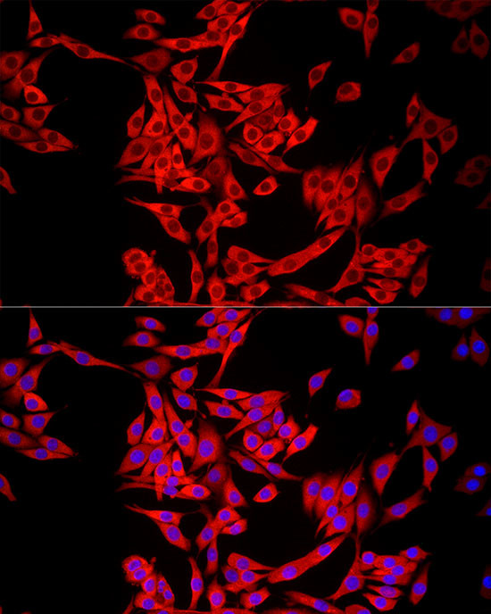 MTAP Antibody in Immunocytochemistry (ICC/IF)