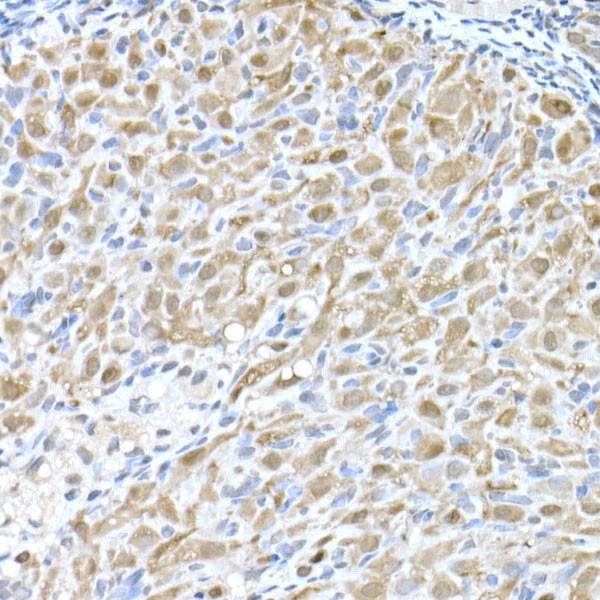 MTAP Antibody in Immunohistochemistry (Paraffin) (IHC (P))