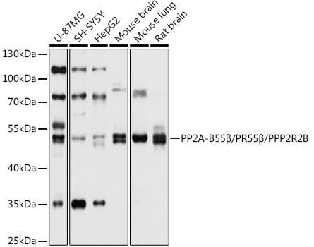 PPP2R2B Antibody in Western Blot (WB)