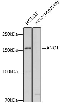 DOG-1 Antibody in Western Blot (WB)