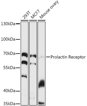 Prolactin Receptor Antibody in Western Blot (WB)