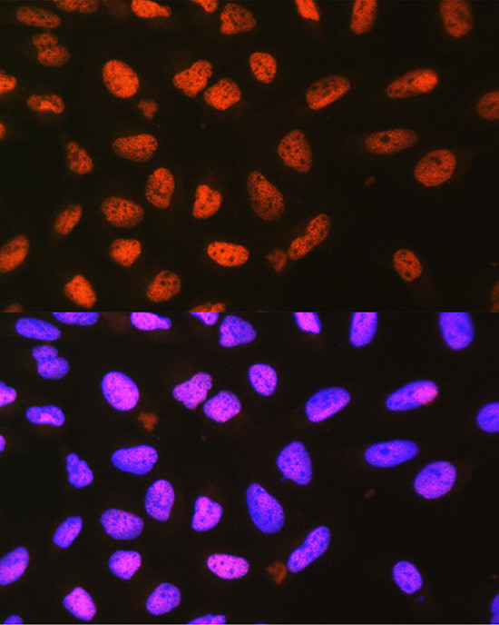 P4HA1 Antibody in Immunocytochemistry (ICC/IF)