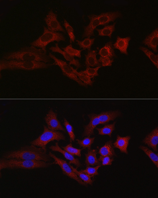 HK1 Antibody in Immunocytochemistry (ICC/IF)