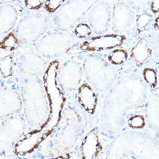 HK1 Antibody in Immunohistochemistry (Paraffin) (IHC (P))