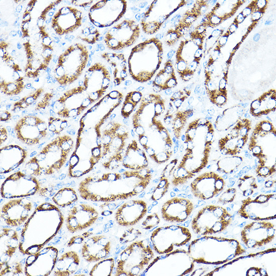 HK1 Antibody in Immunohistochemistry (Paraffin) (IHC (P))