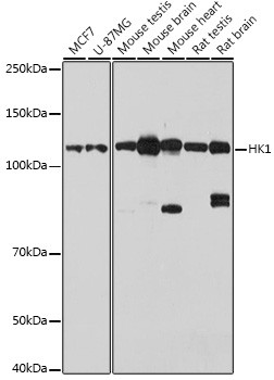 HK1 Antibody in Western Blot (WB)