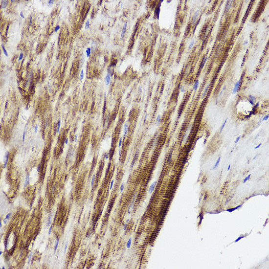 PLOD3 Antibody in Immunohistochemistry (Paraffin) (IHC (P))