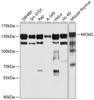 MCM2 Antibody in Western Blot (WB)