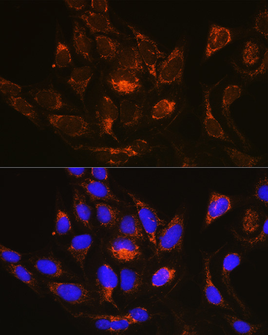 RAB13 Antibody in Immunocytochemistry (ICC/IF)