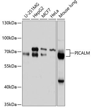 CALM Antibody in Western Blot (WB)