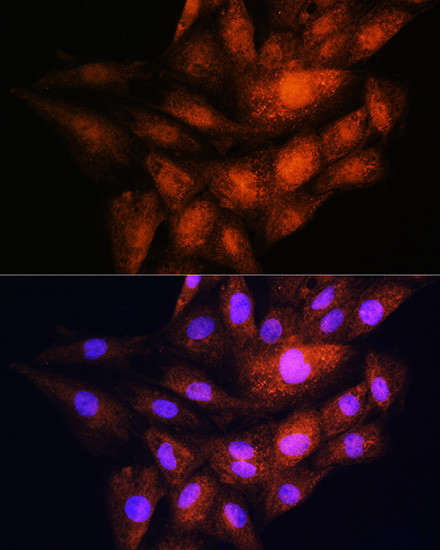 14-3-3 epsilon Antibody in Immunocytochemistry (ICC/IF)