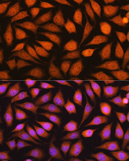 14-3-3 epsilon Antibody in Immunocytochemistry (ICC/IF)