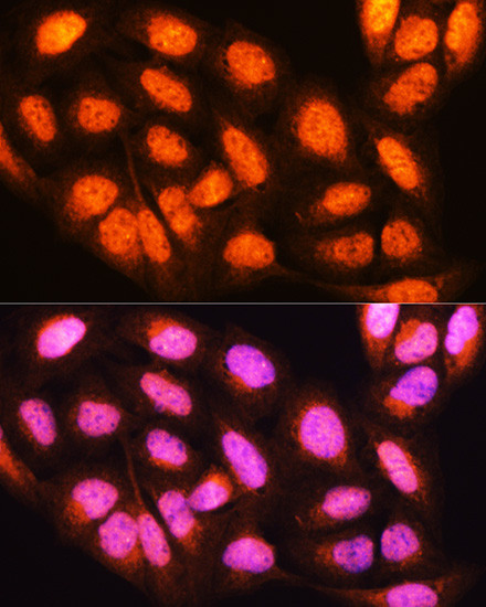 14-3-3 epsilon Antibody in Immunocytochemistry (ICC/IF)