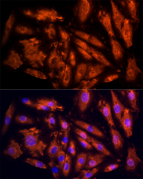 IL17C Antibody in Immunocytochemistry (ICC/IF)