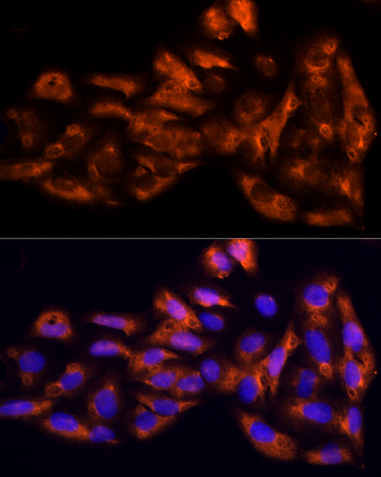 IL17C Antibody in Immunocytochemistry (ICC/IF)