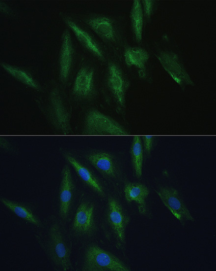 SRPRB Antibody in Immunocytochemistry (ICC/IF)