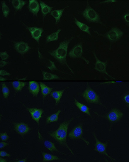 SRPRB Antibody in Immunocytochemistry (ICC/IF)