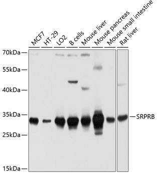 SRPRB Antibody in Western Blot (WB)