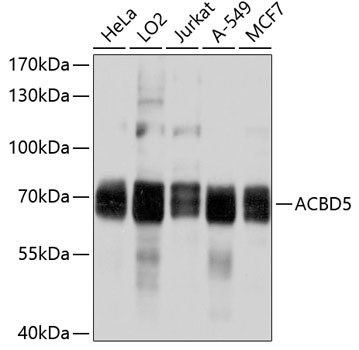 ACBD5 Antibody in Western Blot (WB)