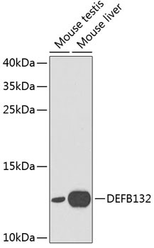 DEFB132 Antibody in Western Blot (WB)