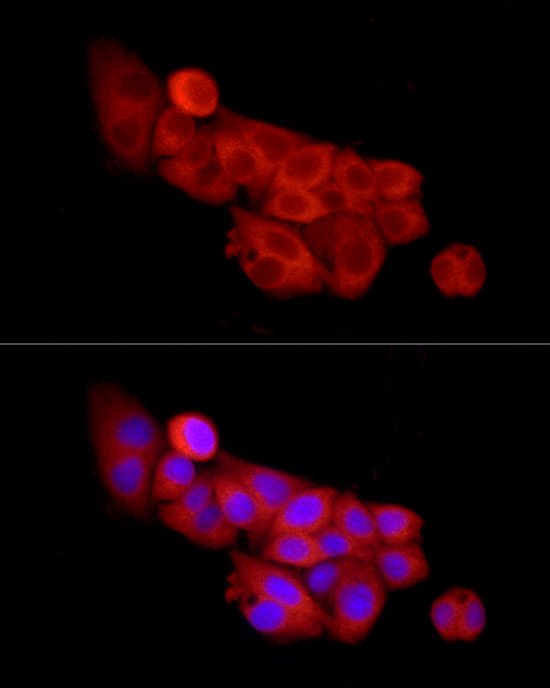 SLC27A2 Antibody in Immunocytochemistry (ICC/IF)