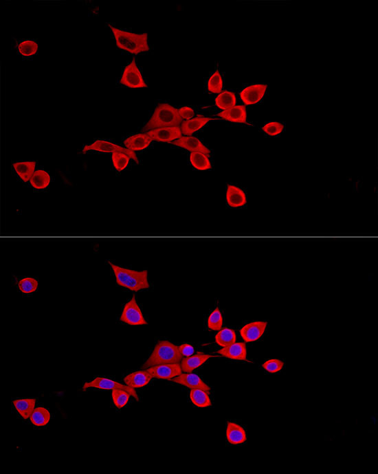 SLC27A2 Antibody in Immunocytochemistry (ICC/IF)