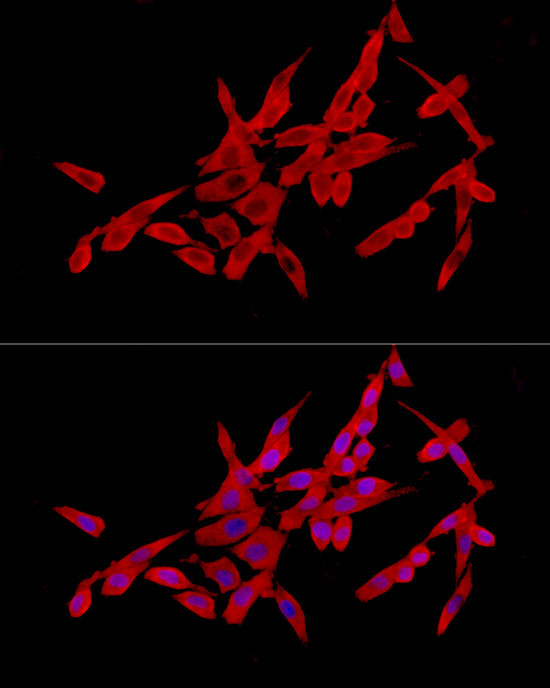 SLC27A2 Antibody in Immunocytochemistry (ICC/IF)