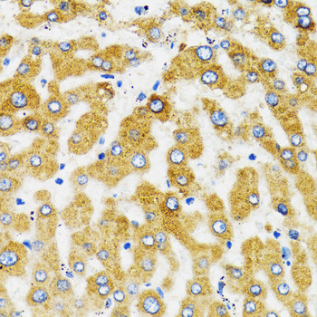 SLC27A2 Antibody in Immunohistochemistry (Paraffin) (IHC (P))