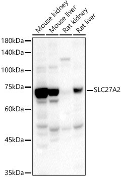 SLC27A2 Antibody in Western Blot (WB)