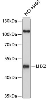 LHX2 Antibody in Western Blot (WB)