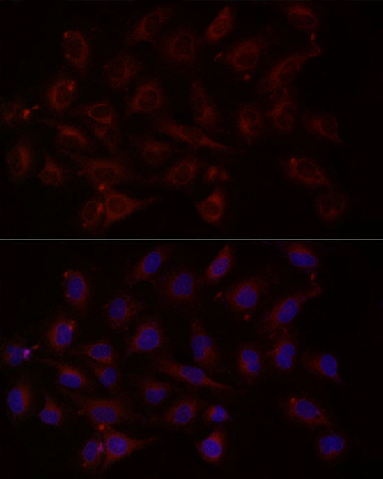 NTF4 Antibody in Immunocytochemistry (ICC/IF)