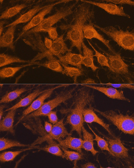 SDHB Antibody in Immunocytochemistry (ICC/IF)