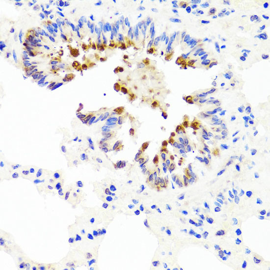 AMBRA1 Antibody in Immunohistochemistry (Paraffin) (IHC (P))