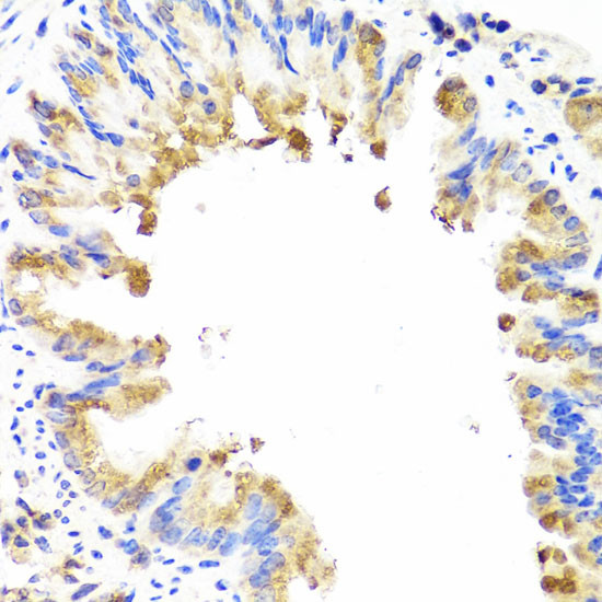 AMBRA1 Antibody in Immunohistochemistry (Paraffin) (IHC (P))