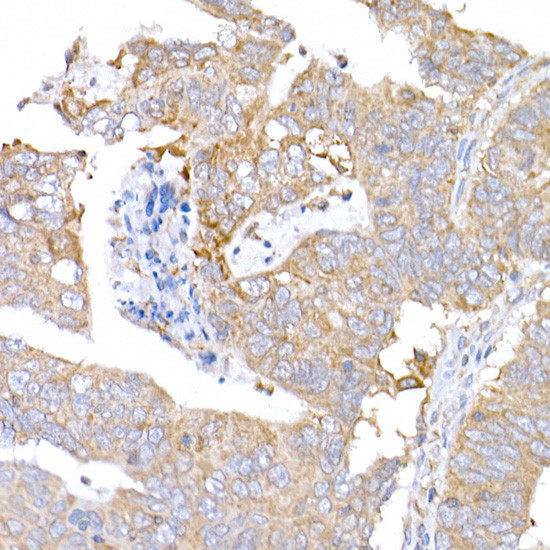 MAGED1 Antibody in Immunohistochemistry (Paraffin) (IHC (P))