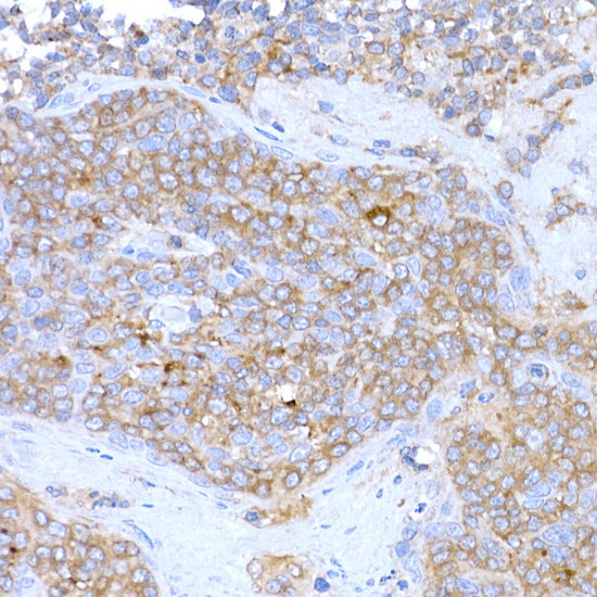 MAGED1 Antibody in Immunohistochemistry (Paraffin) (IHC (P))