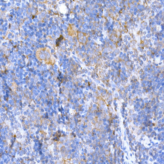 MAGED1 Antibody in Immunohistochemistry (Paraffin) (IHC (P))