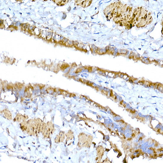 MAGED1 Antibody in Immunohistochemistry (Paraffin) (IHC (P))