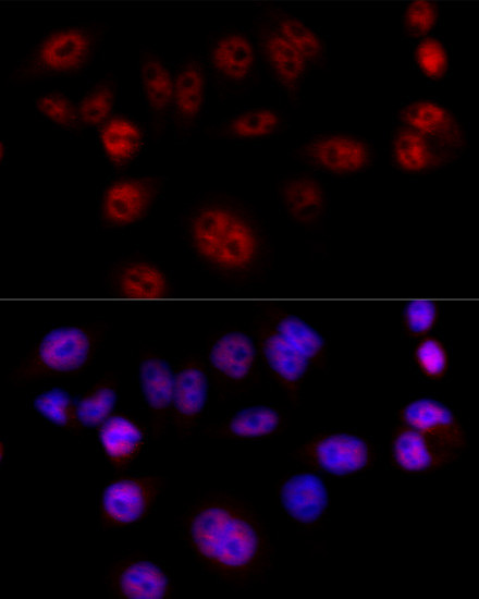 Cyclin D1 Antibody in Immunocytochemistry (ICC/IF)