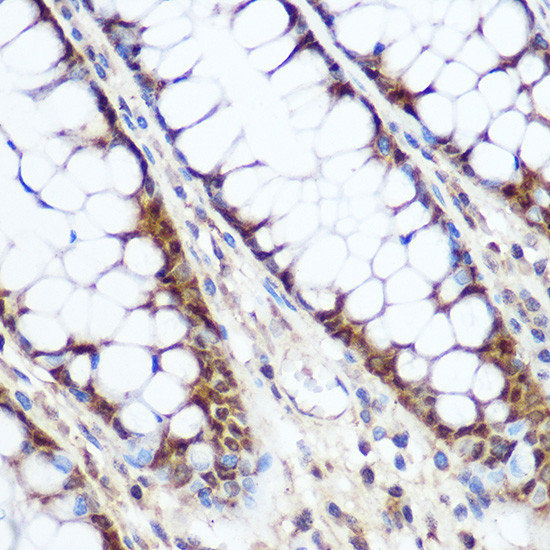 Cyclin D1 Antibody in Immunohistochemistry (Paraffin) (IHC (P))