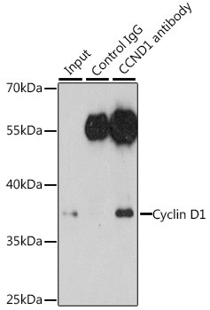 Cyclin D1 Antibody in Immunoprecipitation (IP)