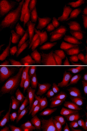 BAG1 Antibody in Immunocytochemistry (ICC/IF)