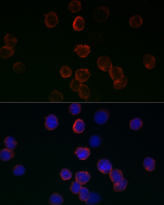 GPX1 Antibody in Immunocytochemistry (ICC/IF)