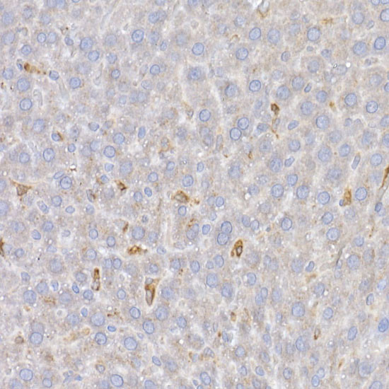 HMOX1 Antibody in Immunohistochemistry (Paraffin) (IHC (P))