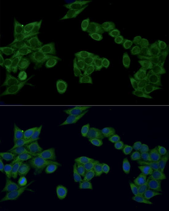 IRF3 Antibody in Immunocytochemistry (ICC/IF)