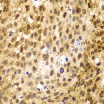 IRF3 Antibody in Immunohistochemistry (Paraffin) (IHC (P))