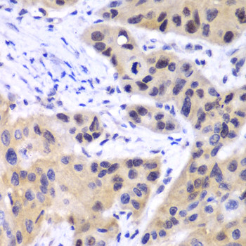 IRF3 Antibody in Immunohistochemistry (Paraffin) (IHC (P))