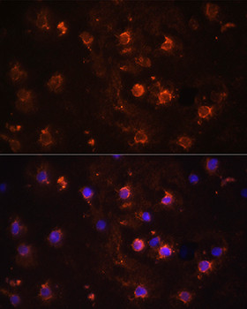 IL-1 beta Antibody in Immunocytochemistry (ICC/IF)