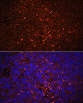 IL-1 beta Antibody in Immunohistochemistry (Paraffin) (IHC (P))