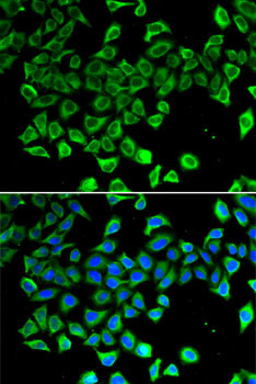 NGAL Antibody in Immunocytochemistry (ICC/IF)